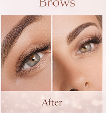 Gallery image brows after